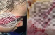 حمله سگ‌های ولگرد به جان کودک ۵ ساله در تبریز