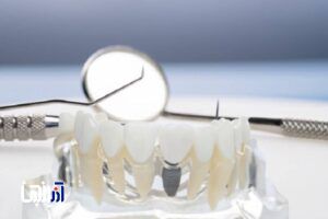 دندانساز تجربی نداریم؛ بگویید دندانساز غیرمجاز!