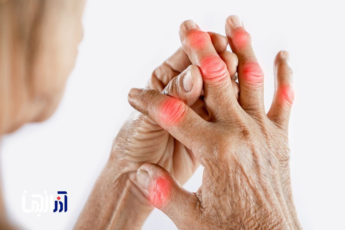 چگونه درد مفاصل را کنترل و درمان کنیم؟