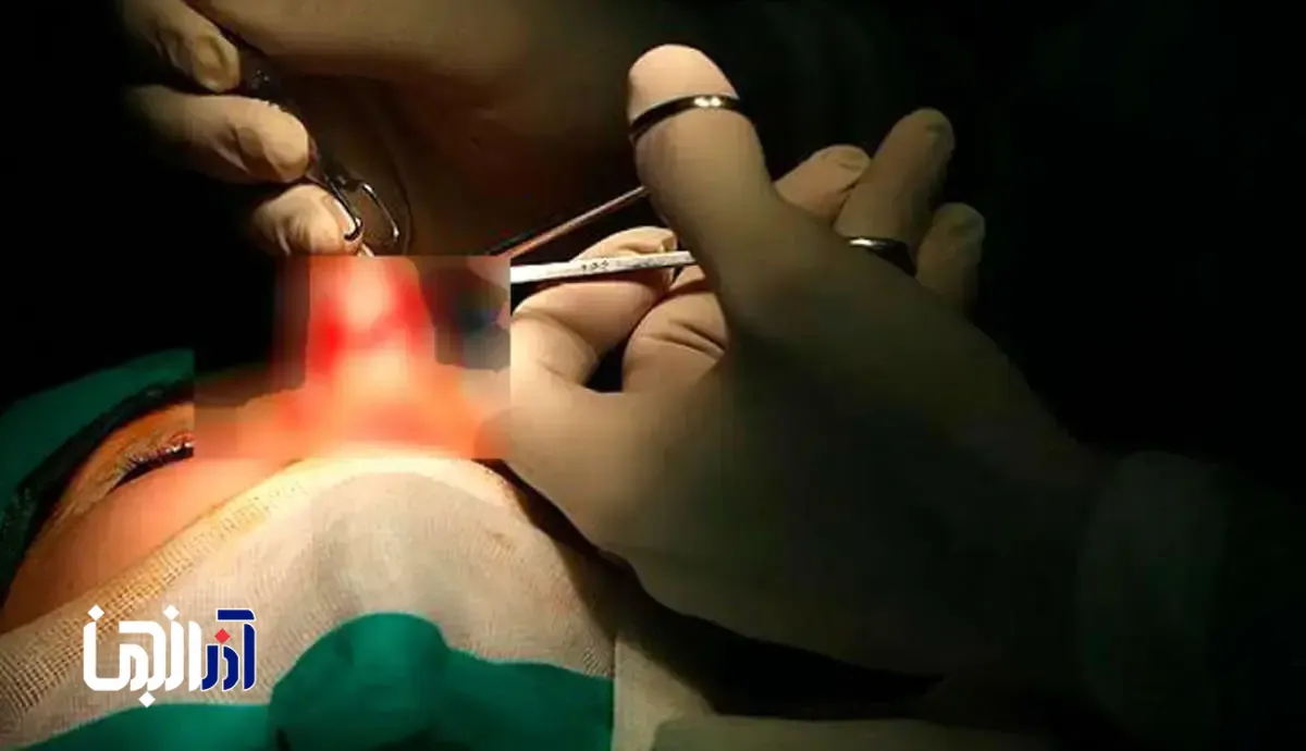 زن جوان هنگام عمل جراحی بینی جان باخت/ یک سلبریتی برای تبـلیـغ کلینیک زیبایی دستمزد ۹ میلیاردی گرفته بود