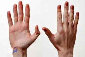 چرا اکثر انسان ها راست دست هستند؟