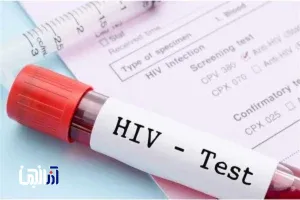 مهم‌ترین چالش امروز HIV در ایران