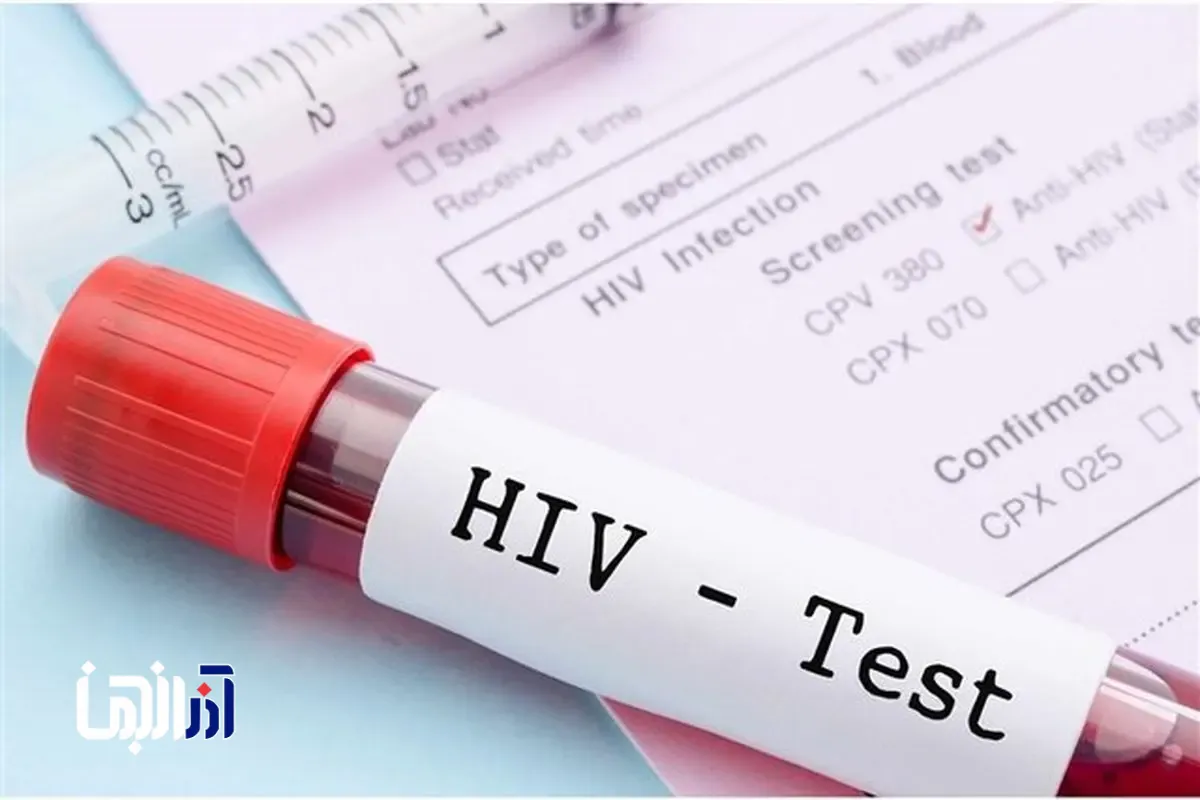 مهم‌ترین چالش امروز HIV در ایران